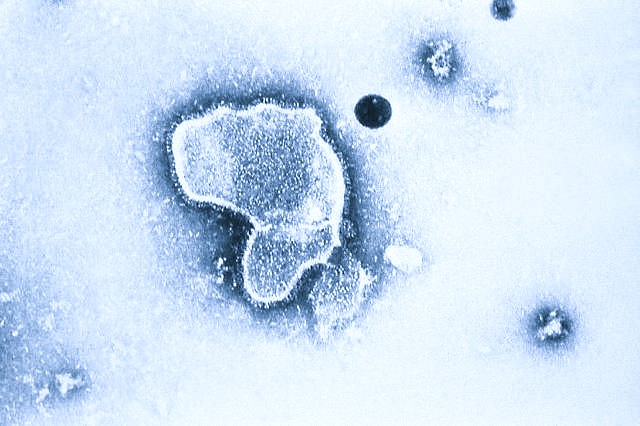 Respiratory syncytial virus (RSV).