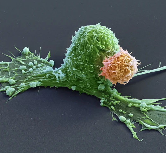 A CAR-T cell (orange) has attacks a cancer cell (green), which is starting to contract.
