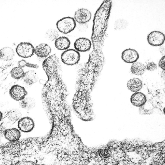 Microscopia electronica de Hantavirus - Centers for Disease Control and Prevention