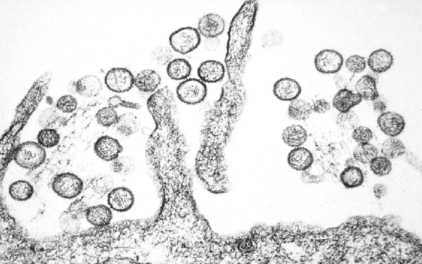 Microscopia electronica de Hantavirus - Centers for Disease Control and Prevention